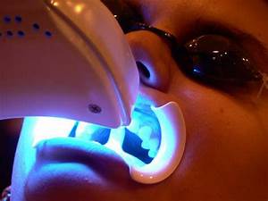 Patient getting Zoom Advanced Whitening